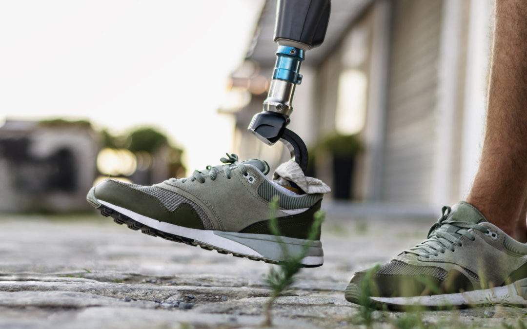 Acquiring A Disability